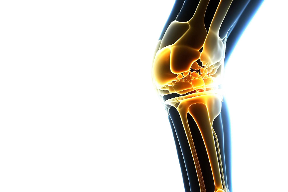 Orthopedics
